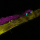 Image for article titled This Fungus Is Growing All Over Your Body